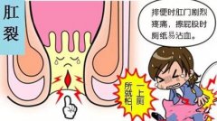 福州女人治疗肛裂好的医院在哪