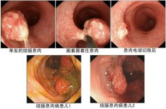 福州医博肛医院主任