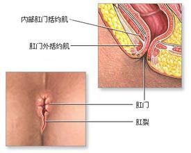 福州哪家医院治疗肛裂 