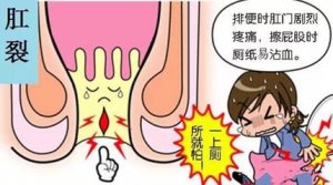 福州哪家医院治疗肛裂 