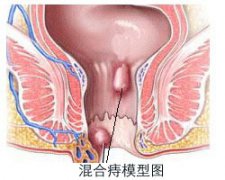 福州痔疮医院地址